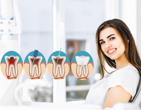 A smiling woman sitting in a dental chair, with illustrations of the stages of a root canal treatment shown next to her, from the initial infected tooth to the final filling
