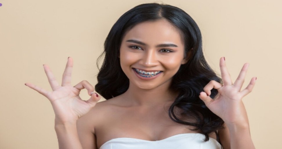 What Are the Ceramic Braces vs Metal Braces? A Complete Guide to Choosing the Right Braces